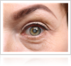 Cataract Treatment in Chicago by Gerstein Eye Institute